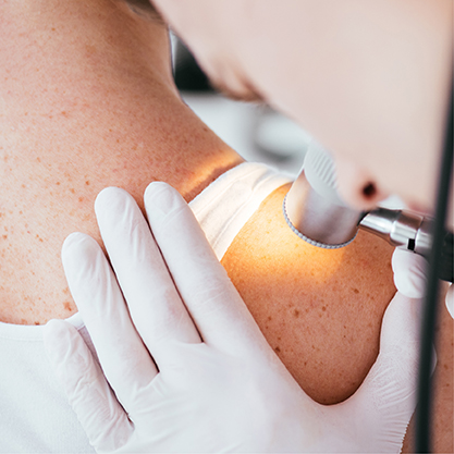 Skin Cancer & Melanoma Awareness